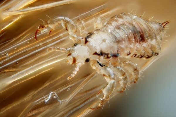Kopflaus, Quelle: Gilles San Martin - originally posted to Flickr as Male human head louse - via Wikipedia